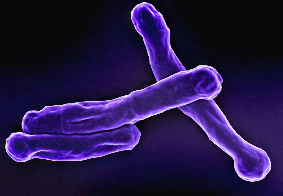 Which Probiotic Has the Most Lactobacillus? A Gut Health Expert’s No-BS Guide